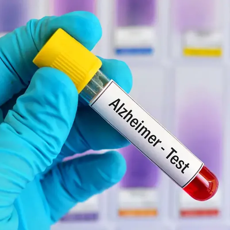 Carolina Neurology, Blood, Biopsy, Dementia